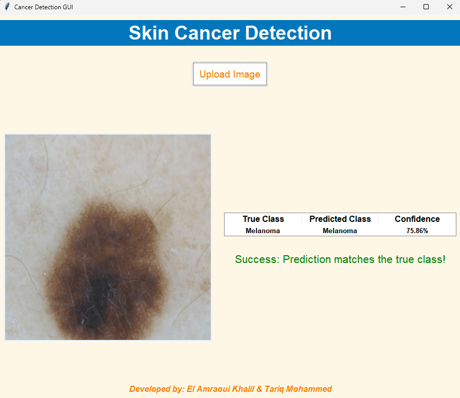 Skin Lesion Classification preview